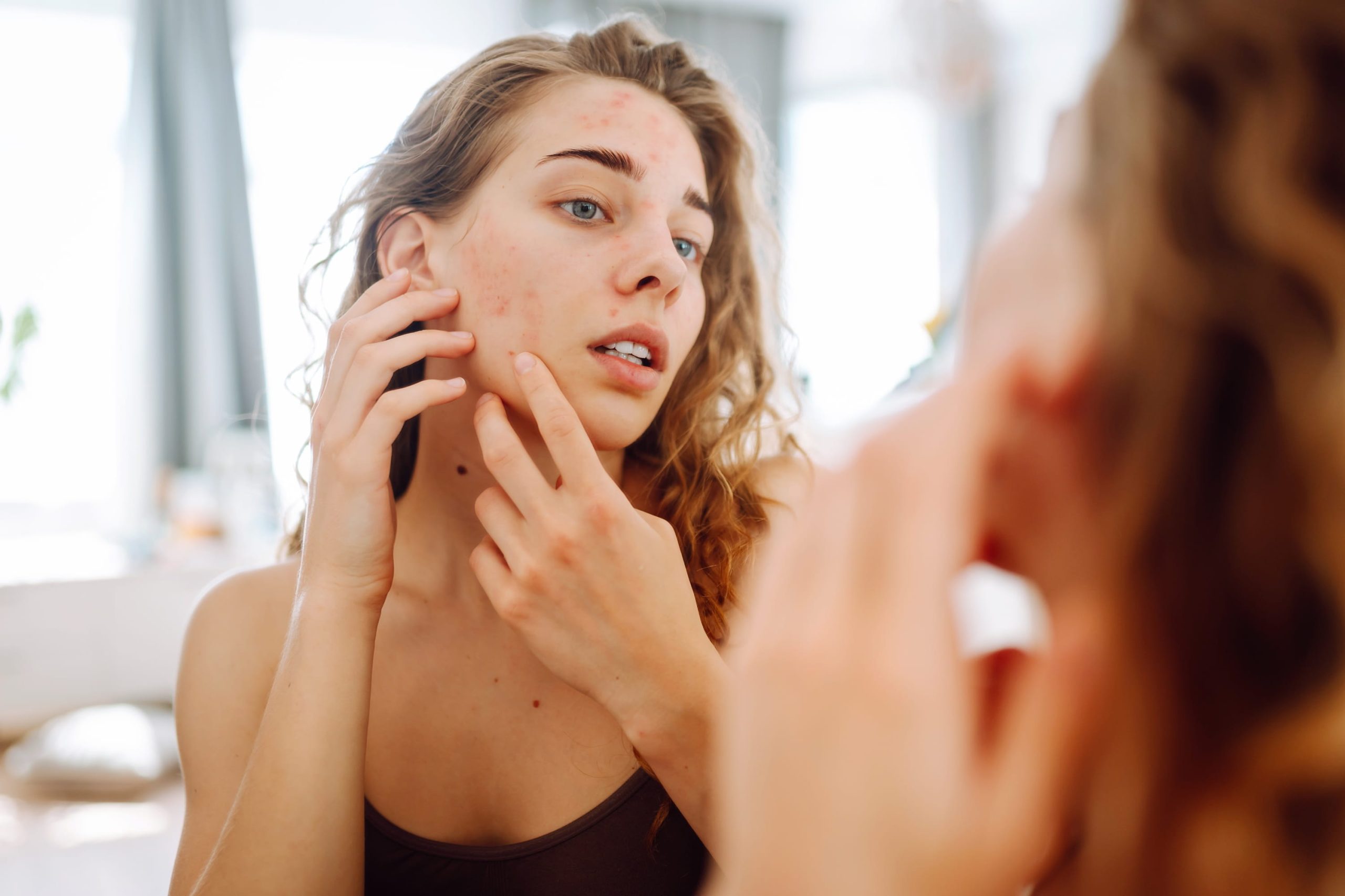 Young woman inspecting acne on her cheek in a mirror to see if her bedding causes breakouts